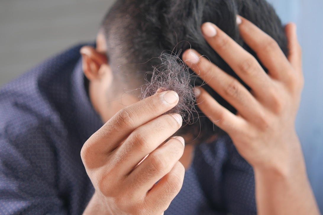 Stress och hårhälsa: Hur påverkar livsstil ditt hår?